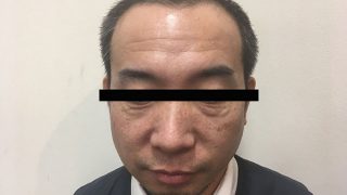 寝るのが先かお仕事が先か育毛が先かとにかく寝不足には気を付けよう