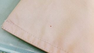 シミの様に見えてもシミではない時もあります固定概念には要注意です