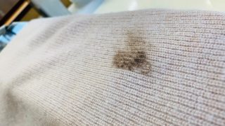 お洋服に毛染めの液が付いてしまったので何とかして欲しいと言うご依頼をお受け致しました