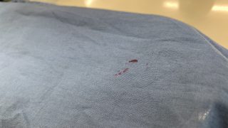 マニキュアがお洋服に付いてしまった時には焦って除光液で擦りがちですがそれ危険です