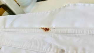今回の様な襟裏部分のピンポイントタンパク質のシミの殆どの場合は擦り傷による外傷やアトピーなどによる汚れです