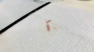 時間が経ったタンパク質のシミは付いてしまった汚れが酸化（腐食）して変化してしまいかなり取れにくくなります