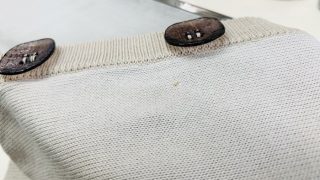 小さい小さい金色に近い黄色の小さなシミは無理に取り除こうと致しますと穴が空いたりするので要注意です