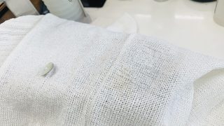 長期保管中に発生した黄ばみですが実は何もない場所に突然出来るものではなく原因があるのです