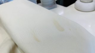 元々は濃くなかったシミですが時間が経つと濃いシミに変わってしまうのには理由があります