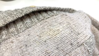 お直し前に取り切れていない汚れ成分は時間と共にシミから変色になり色素を破壊してしまいます
