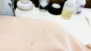 長時間保管中に浮き出てきた濃い色のシミは生地や色をかなり傷めてしまっている場合が多いのです